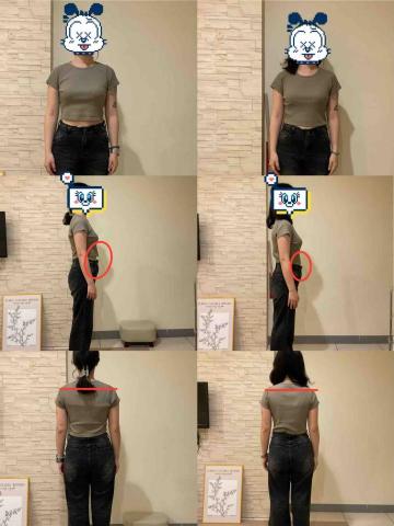 米拉按摩 - 骨盆型態調整也能減少小腹凸出、高低肩平衡