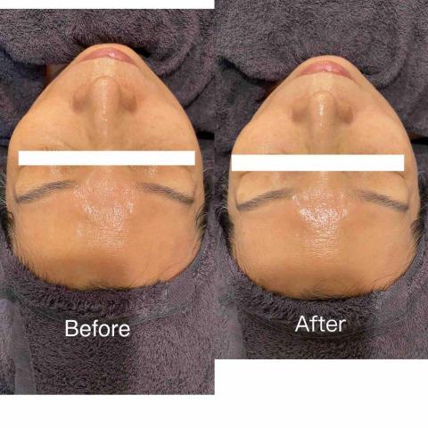 沐玥美學 - 臉部提亮保濕