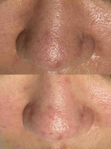 療TO美學 -  療TO美學 -