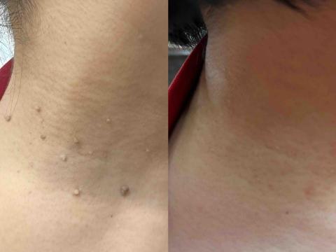 療TO美學 -  療TO美學 -