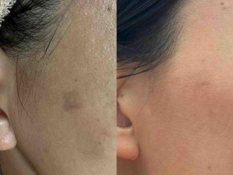 療TO美學 -  療TO美學 -