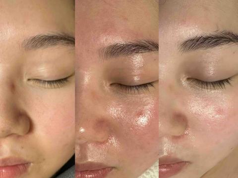 療TO美學 -  療TO美學 -