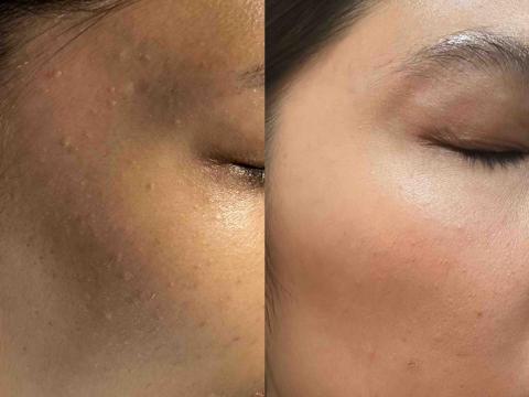 療TO美學 -  療TO美學 -