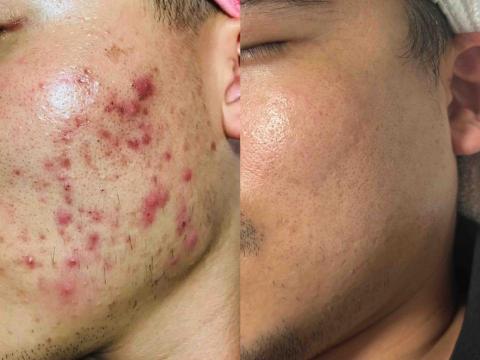 療TO美學 -  療TO美學 -