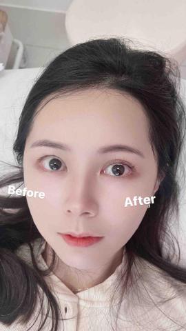 yuluv - 日式單根嫁接前後