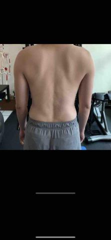 板橋 有個人訓練場地 （重訓運動按摩） - 左側肩胛骨訓練後