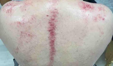 逸級刮痧-MGA科學刮痧 - 