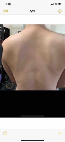 板橋 有個人訓練場地 （重訓運動按摩） - 左側肩胛骨偏位前