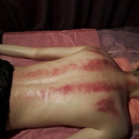 舒雅心動舒壓 - 壓力困擾著您的身心？刮痧，拔罐  讓我為您釋放壓力和緩解肌肉疼痛。提前預約，享受短時間內的專屬按摩治療！