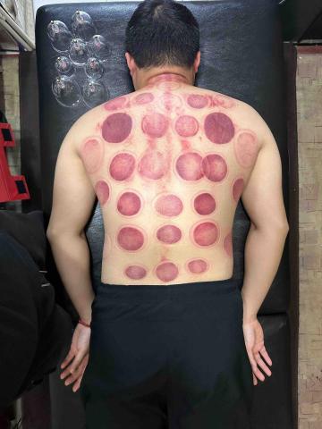 Kiwi 健身教練｜整復師｜居家運動｜私人訓練 - 傳統整復服務