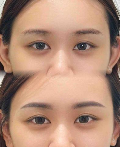 V.A美學 瑞拉老師 - 霧眉：改舊眉