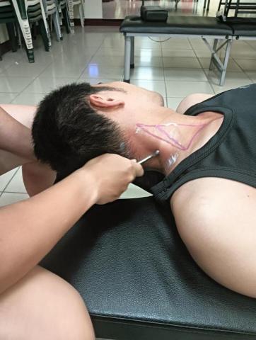 筋鬆小品 - 筋膜刀