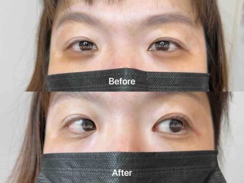 Chao Studio - 黑眼圈遮瑕