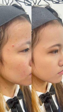 Yimu - 底妝前後對比圖