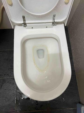 鍾小姐 - 清潔前