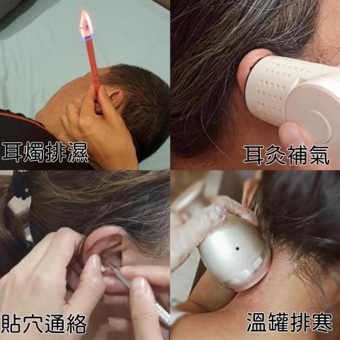 Earheal33 - 