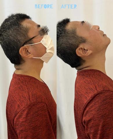 林蔚媗 - 肌筋膜放鬆前後對比