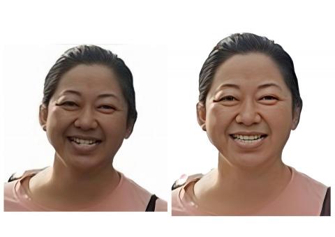 張孟晴 - 超高階牙齒修復 無任何AI參雜！
所以可依顧客需求隨意調整 不受AI所限！！！