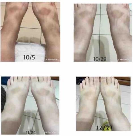 陳敬仁 - 雪姬案例照