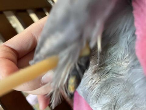 JC - 鴿寶貝粉瘤去除紀錄