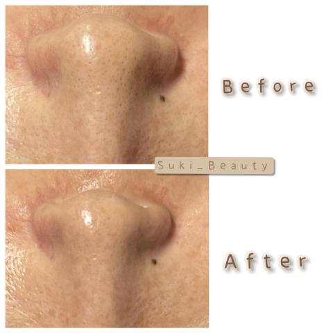 Suki_Beauty皮膚管理 - 