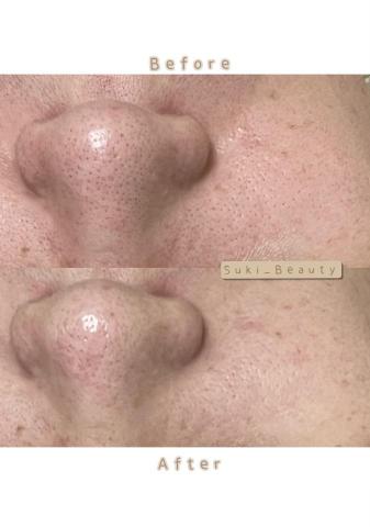 Suki_Beauty皮膚管理 - 