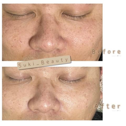 Suki_Beauty皮膚管理 - 