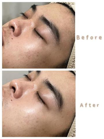 Suki_Beauty皮膚管理 - 