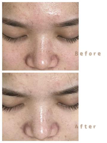 Suki_Beauty皮膚管理 - 