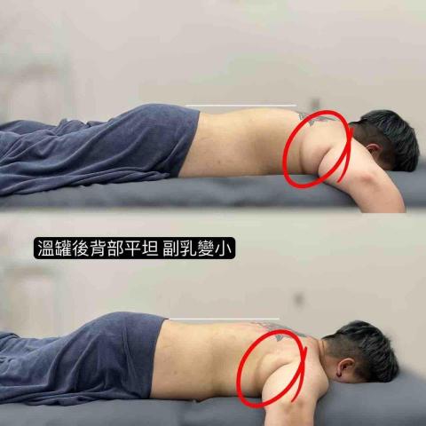 綠之草美學 - 溫罐前後