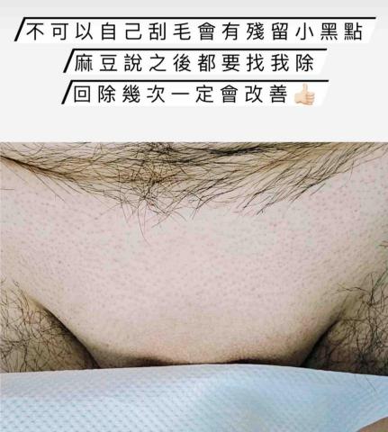 一絲不苟熱蠟美肌工作室 - 私密處