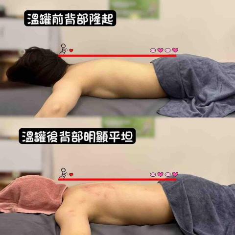 綠之草美學 - 溫罐前後