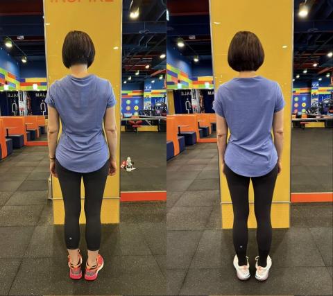 yang vicky - 這位客戶原本面臨高低肩、頸椎退化引起的手麻，以及腰椎退化導致的長期腰酸等困擾，這些問題嚴重影響了日常生活和活動的舒適度。然而，在持續訓練約半年後，她的情況有了顯著改善，並且這些進步也成功穩定下來。透過堅持不懈的努力，她不僅克服了這些困難，還成功讓身體狀況達到了一個新的穩定狀態。
這樣的成果展現了她強大的毅力與決心，證明了只要持續付出，身體和健康都能夠得到顯著的改善。