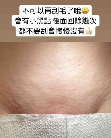 一絲不苟熱蠟美肌工作室 - 私密處