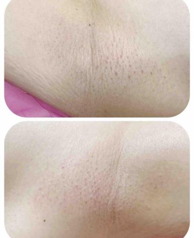 一絲不苟熱蠟美肌工作室 - 腋下