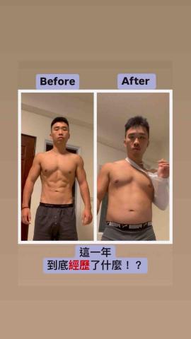 陳暐翔 - 歷經車禍後的鎖骨開放性骨折
且鋼釘不拆除的狀況下從無法伏地挺身到肩推70公斤