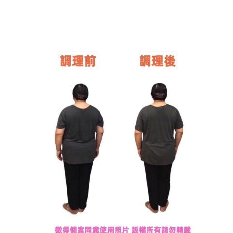 Mika 女整復老師 - 