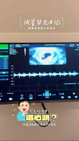 范馨蓉 - 超短影片也可以剪輯，紀錄短暫的一瞬間，短短影片，感動滿滿