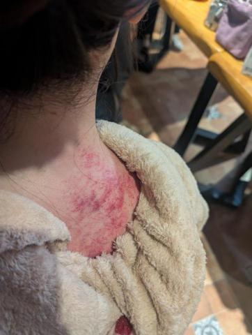 蘇福福福身心美學 - 肩頸舒壓（按摩刮痧）