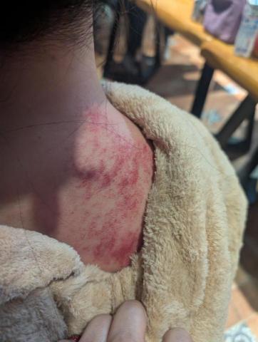 蘇福福福身心美學 - 肩頸舒壓（按摩刮痧）