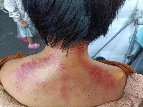 蘇福福福身心美學 - 艾草溫罐（肩頸舒壓）