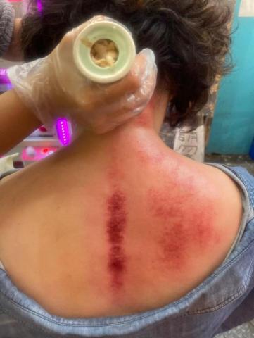 蘇福福福身心美學 - 艾草溫罐（肩頸舒壓）