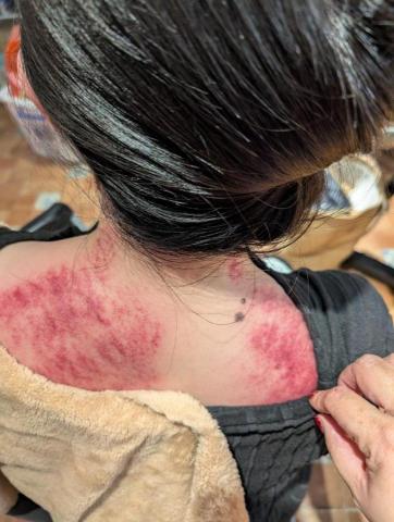 蘇福福福身心美學 - 肩頸舒壓（按摩刮痧）