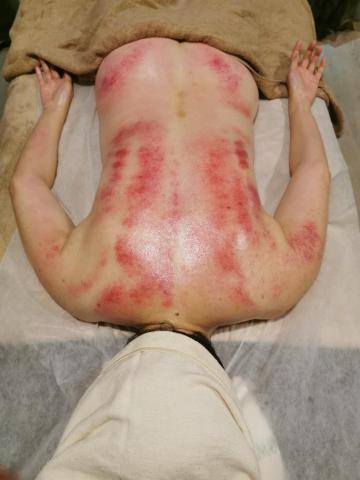 Ennia J - 體刷課程：習慣翹腳兩側腰臀比不同