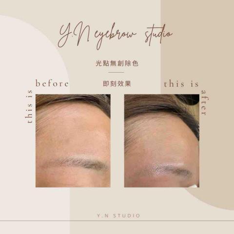 Y.N EYEBROW STUDIO - 無創除色