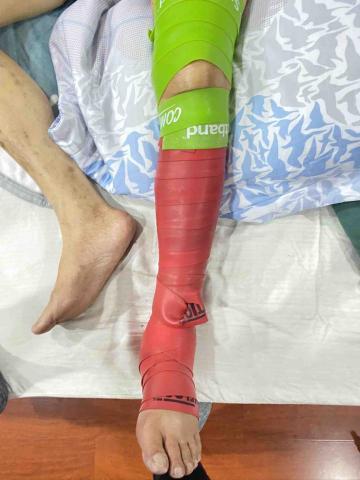 手足運動按摩 - 手術後，幫助康復