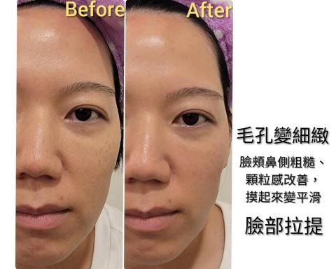 Q家瑜樂活美療坊/Queenie - 美容護膚 Q家瑜樂活美療坊/Queenie - 美容護膚