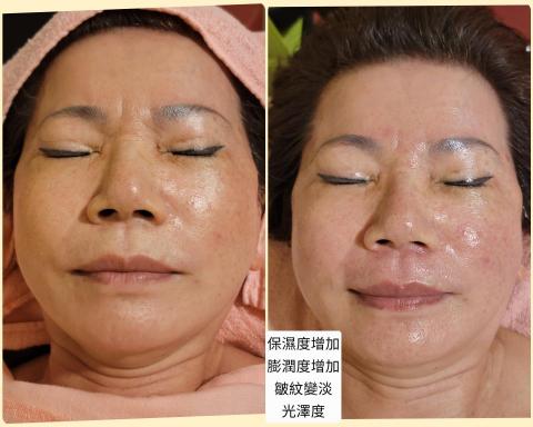 Q家瑜樂活美療坊/Queenie - 美容基礎護膚 Q家瑜樂活美療坊/Queenie - 美容基礎護膚