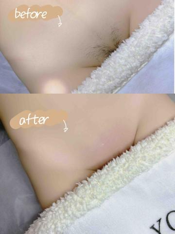 毛趣-桃園男女·熱蠟除毛/大竹孕婦除毛 - 