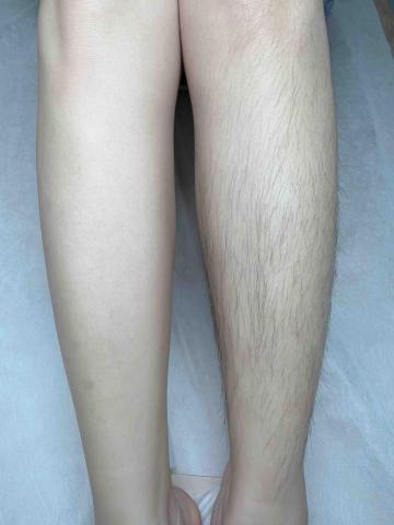 All Beauty｜中壢複合式美學空間・皮膚管理・熱蠟除毛 - 熱蠟除毛